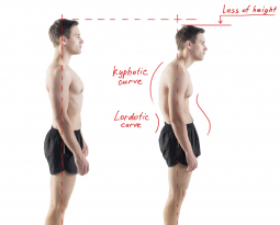 Systematize Your Posture Exams to Optimize Your Outcomes