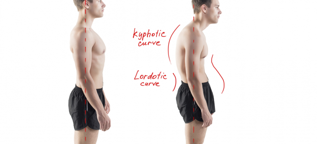 Systematize Your Posture Exams to Optimize Your Outcomes