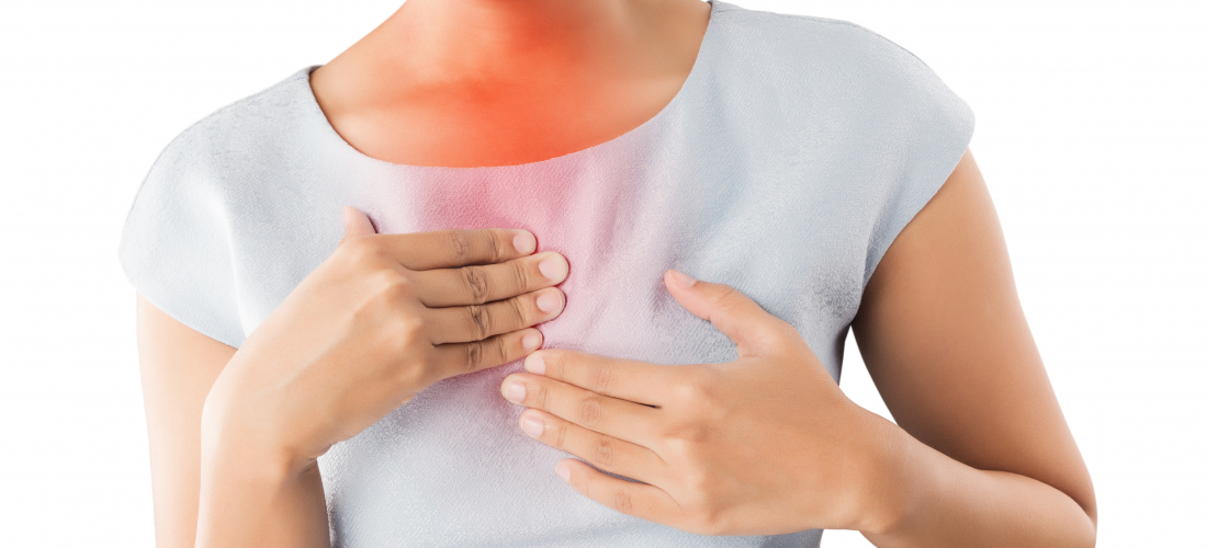 Your heartburn isn’t just from your food. It’s from your posture.
